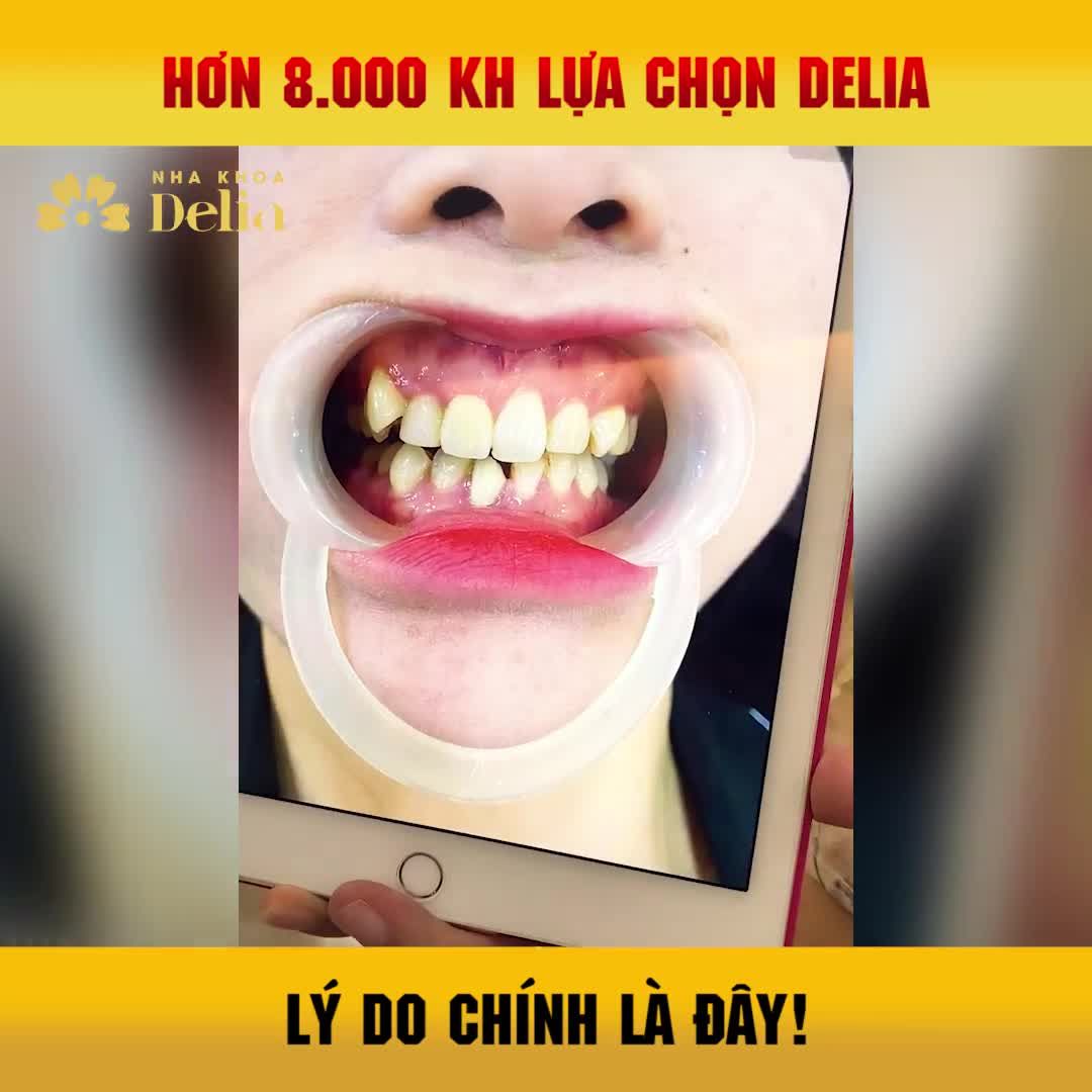 KH Thu Huyền lựa chọn Delia và sở hữu nụ cười như ý