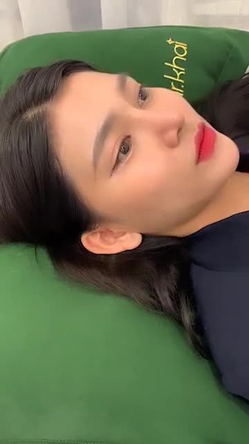 Nâng mũi cấu trúc tái khám sau hậu phẫu