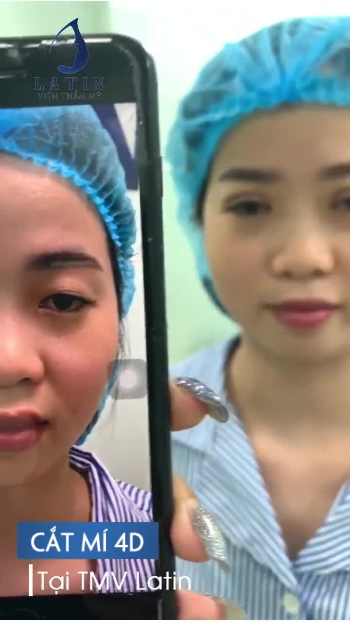 CẬN CẢNH CẮT MÍ MINI 4D KHÔNG ĐAU, KHÔNG SẸO!