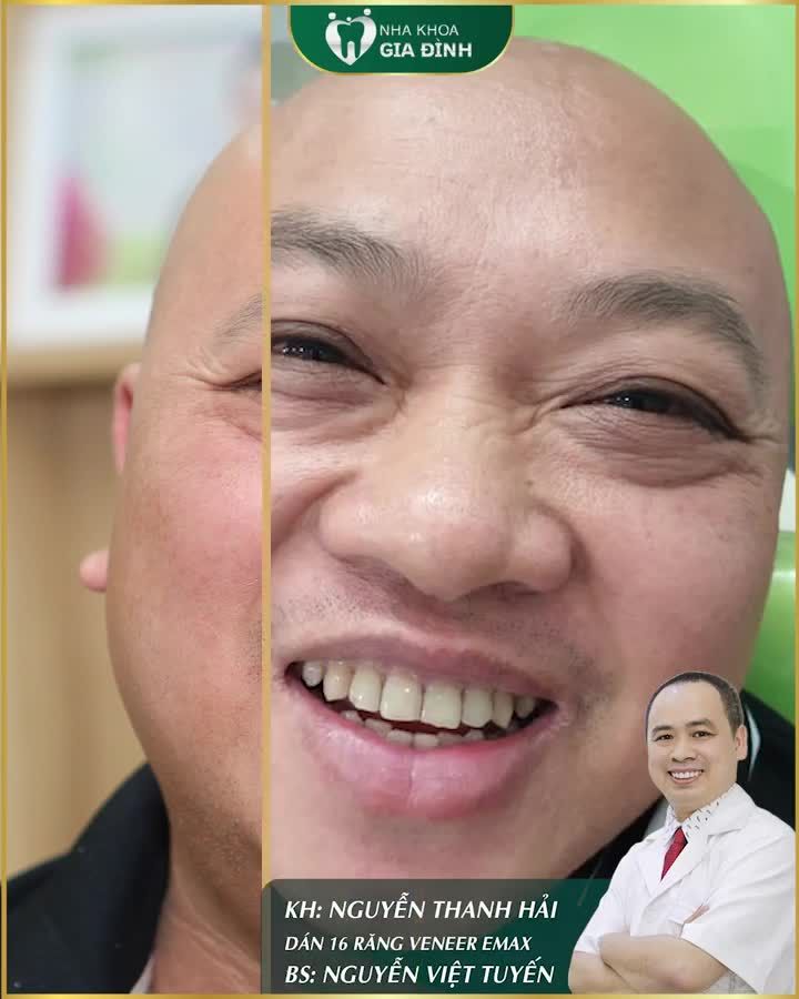 CẶP ĐÔI VÀNG TRONG LÀNG LÀM ĐẸP