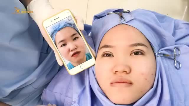 MẮT 1 MÍ KHÔNG PHẢI LÀ XẤU, NHƯNG 2 MÍ CHẮC CHẮN SẼ KHIẾN MẮT BẠN TO TRÒN HƠN