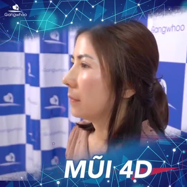 NÂNG CẤP DÁNG MŨI ĐẸP HOÀN HẢO VỚI NÂNG MŨI CẤU TRÚC 4D