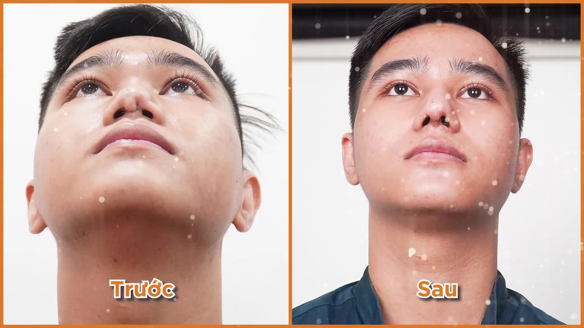 NHỮNG CÚ "LỘT XÁC" BẤT NGỜ CỦA KHÁCH HÀNG AZ NOSE