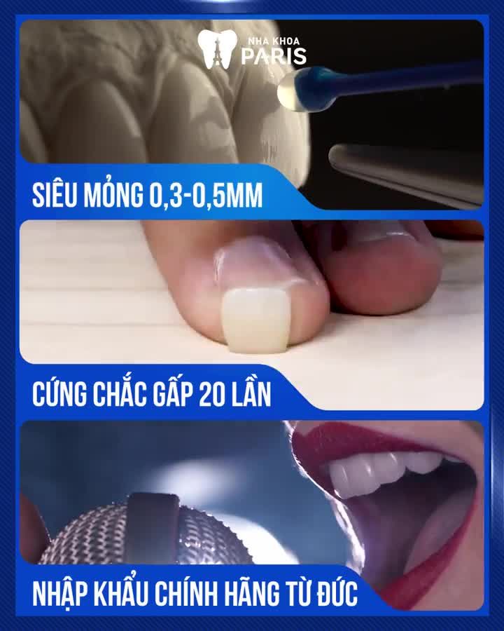 NK Paris TỪ CHỐI bọc răng sứ mài nhiều răng