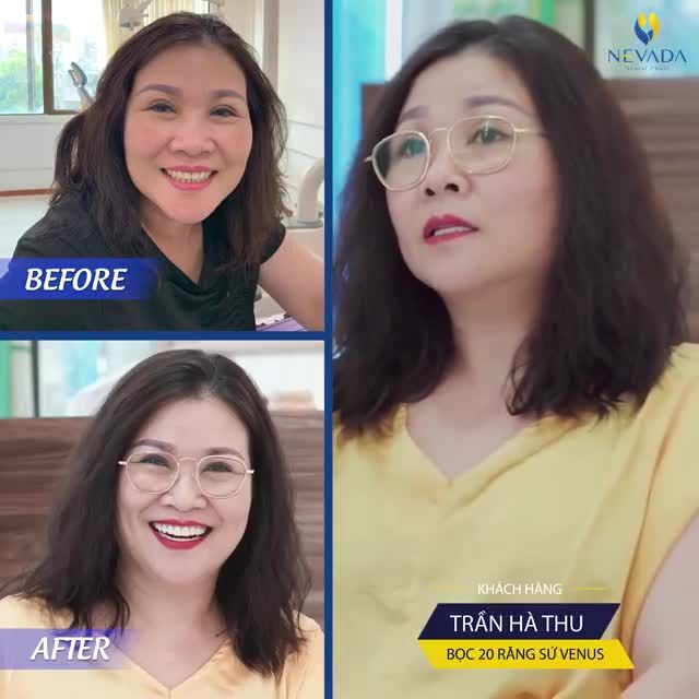 RĂNG TRẮNG SÁNG, ĐIỀU ĐẸP TỰ NHIÊN - ĂN NHAI NHƯ RĂNG THẬT.