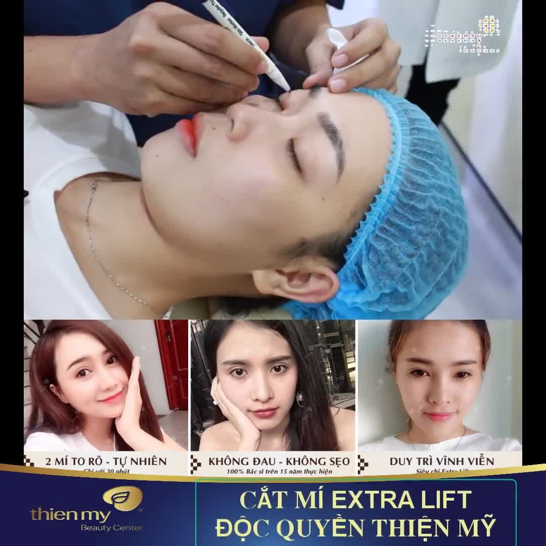 TRỞ NÊN XINH ĐẸP CHỈ 1 LẦN CẮT MÍ TẠI THIỆN MỸ
