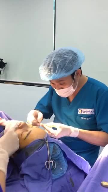 Dáng mũi ngay trên bàn phẫu thuật của bác sĩ Vũ Quang!