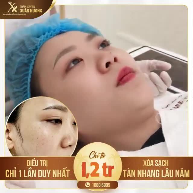 CÔNG KHAI HIỆU QUẢ SẠCH TÀN NHANG 1 LẦN DUY NHẤT CỦA LUCID Q-PTP