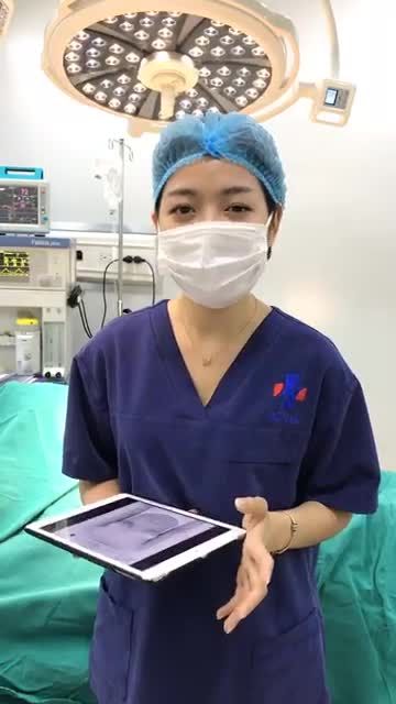 NÂNG CẤP V1 VỚI DÒNG TÚI ARION XUẤT XỨ TỪ PHÁP