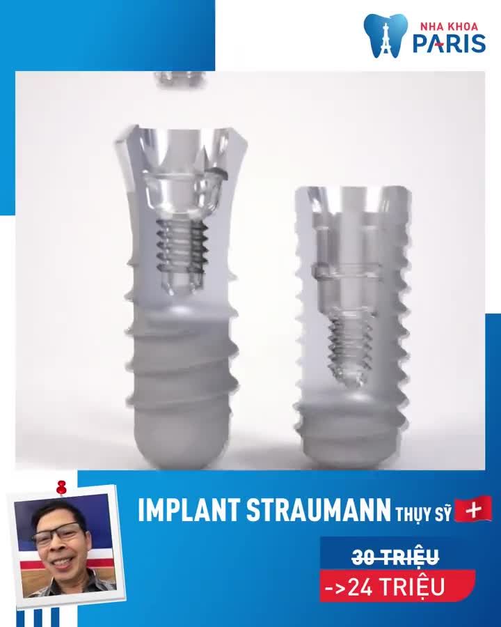 OFF 30% - TRỒNG RĂNG IMPLANT VÔ ĐỊCH VỀ GIÁ