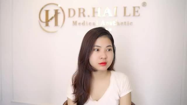 Chỉ 7 ngày "Hồi sinh" nếp mí đẹp ngoài sự mong đợi sau 1 lần nhấn mí hỏng bạn có tin?