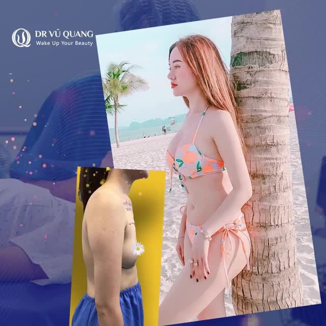 THẨM MỸ VÒNG 1 "MỀM MẠI - TỰ NHIÊN - AN TOÀN"