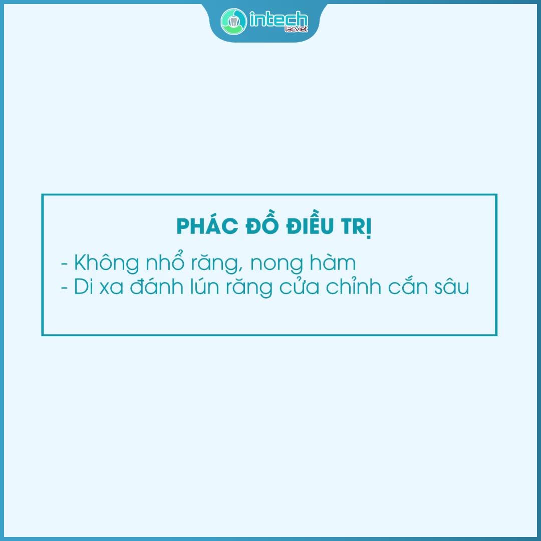 THEO DÕI QUÁ TRÌNH DỊCH CHUYỂN CỦA RĂNG HÔ, KHẤP KHỂNH - XÓA TAN NỤ CƯỜI KÉM DUYÊN BẰNG INVISALIGN