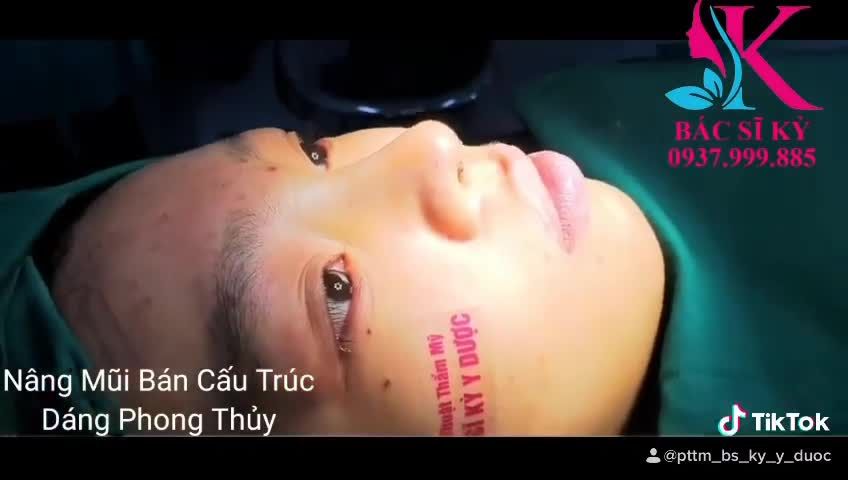 NÂNG MŨI PHONG THUỶ