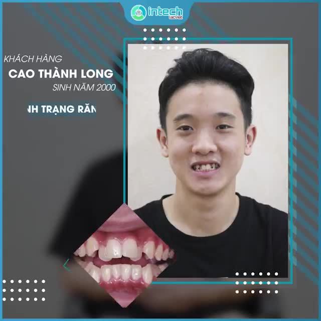 TUỔI ĐÔI MƯƠI - NỤ CƯỜI TƯƠI