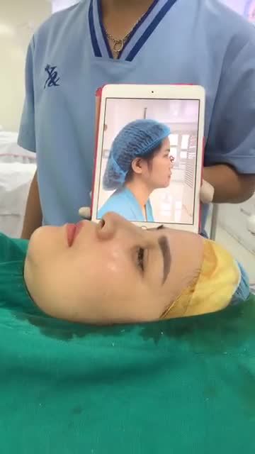 MŨI ĐẸP NGAY SAU 30 PHÚT NÂNG MŨI TẠI TMV XUÂN HƯƠNG