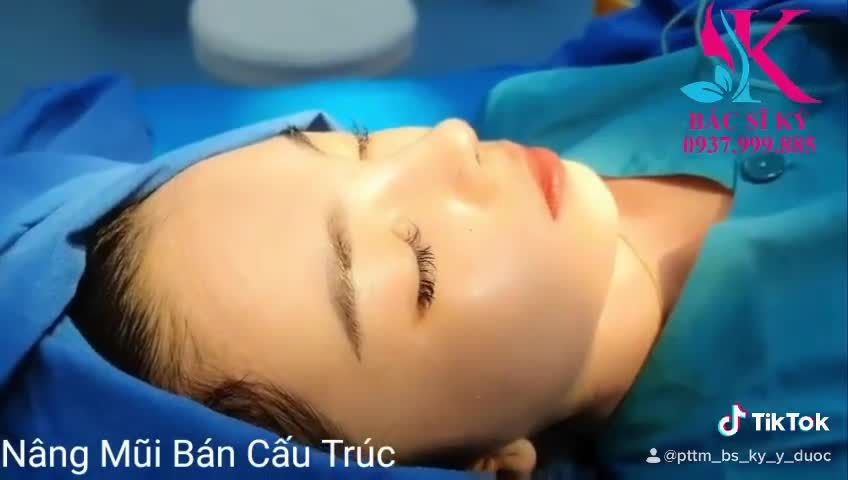 NÂNG MŨI BÁN CẤU TRÚC DÁNG SLINE TỰ NHIÊN NHƯNG KHÔNG KÉM PHẦN CHANH SẢ NHE