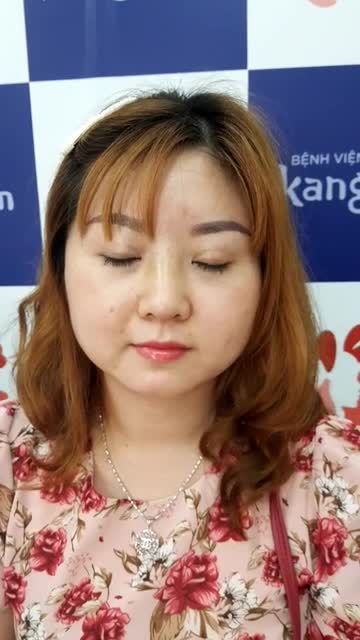 Tái khám cho khách hàng Xinh như búp bê sau khi làm xong dịch vụ Nâng mũi cấu trúc 4D tại BVTM Kangnam