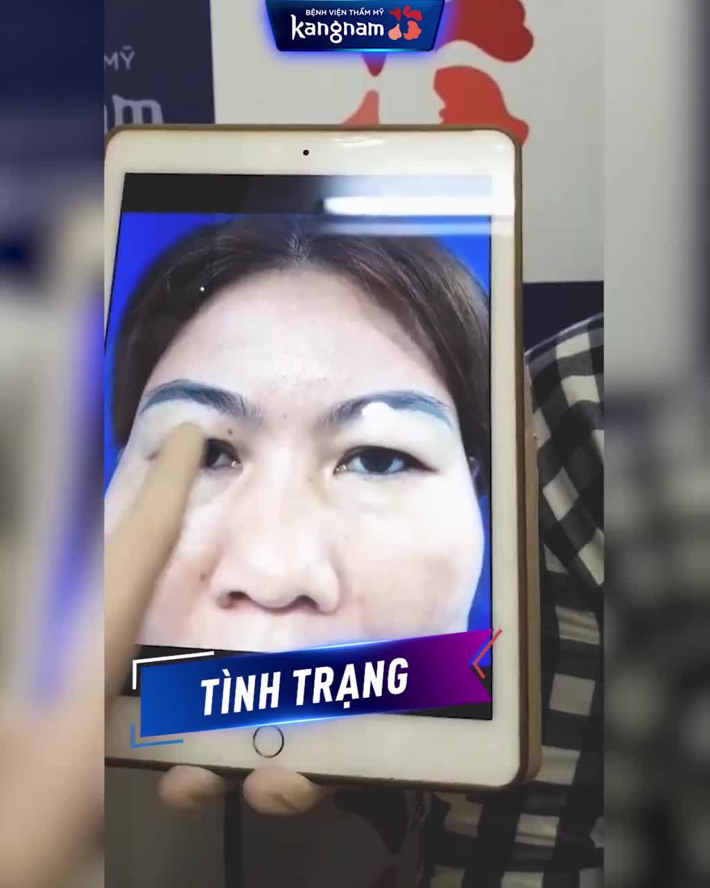 Trẻ ra 10 tuổi chỉ nhờ CẮT MÍ