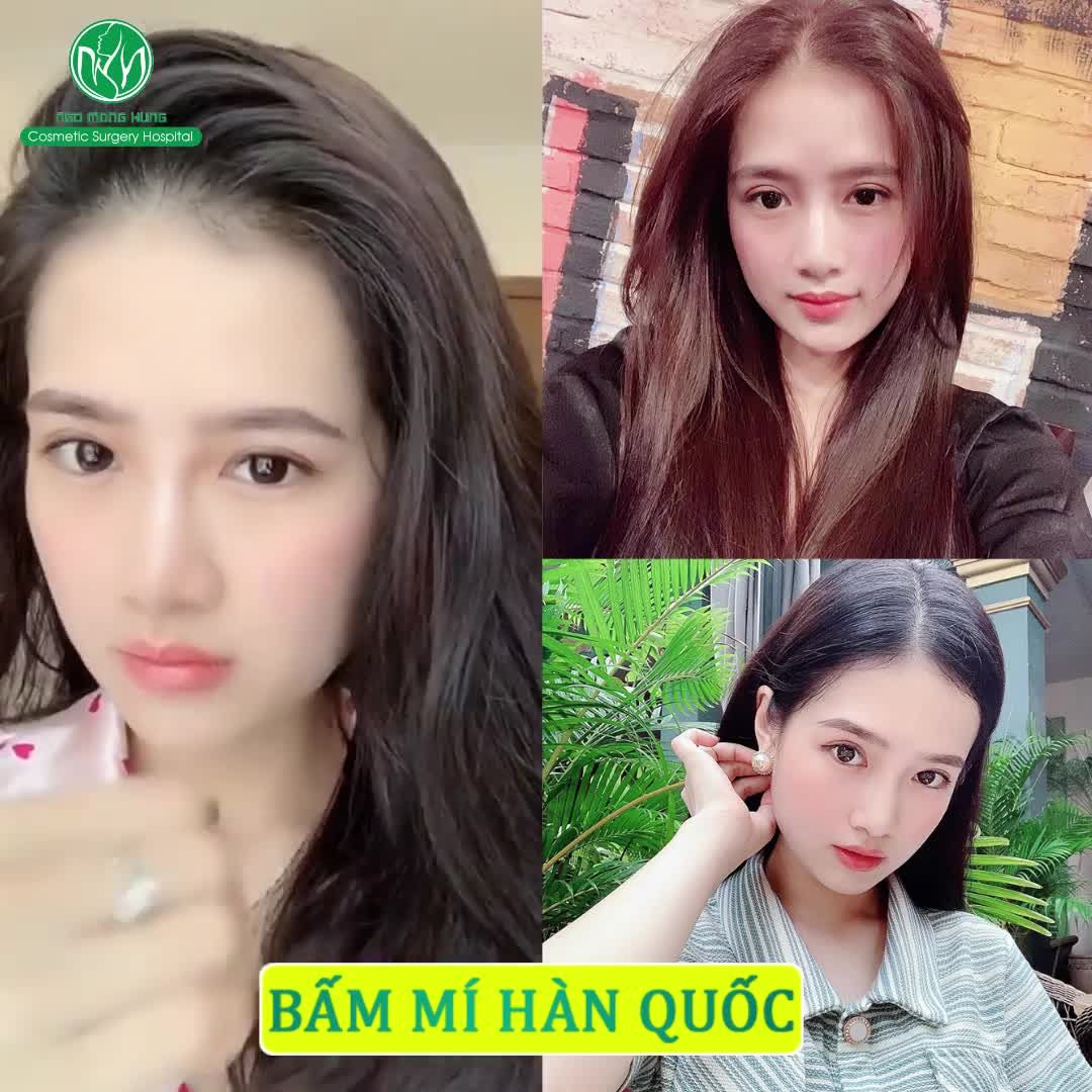 15 Phút SỞ HỮU ĐÔI MẮT 2 MÍ CHUẨN HÀN