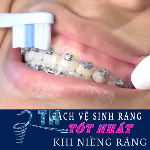 Cách chải răng đúng cách như thế nào