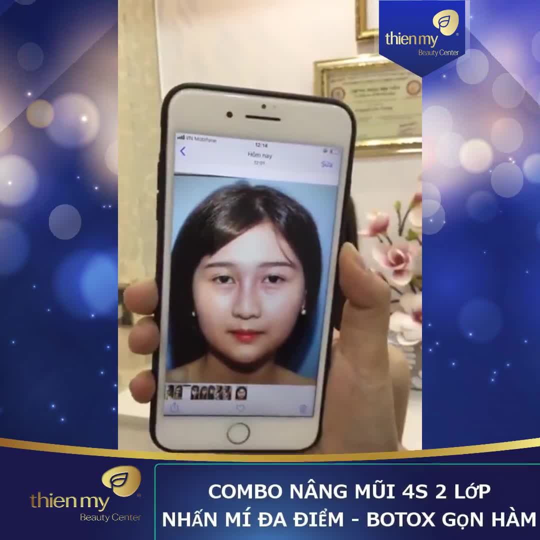 SIÊU COMBO NÂNG MŨI 4S 2 LỚP + NHẤN MÍ ĐA ĐIỂM + TIÊM GỌN HÀM