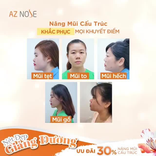 CHƯƠNG TRÌNH "NÉT ĐẸP GIẢNG ĐƯỜNG" ƯU ĐÃI 30% NÂNG MŨI CẤU TRÚC