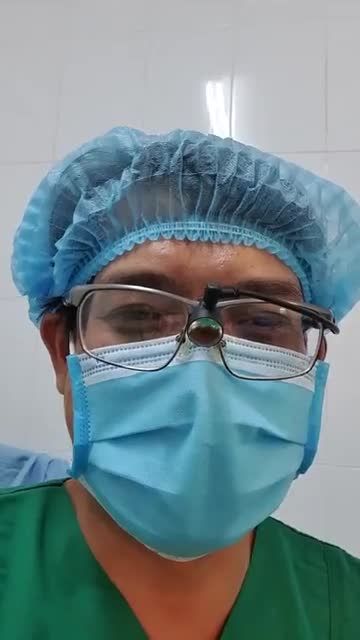 CASE Nâng mũi bán cấu trúc đa lớp cao cấp