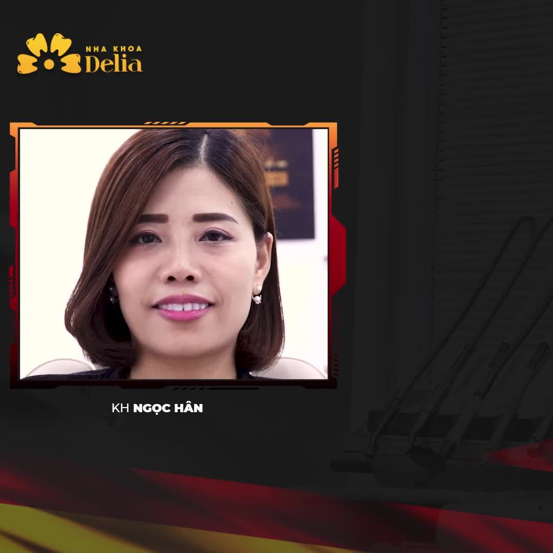 PHỦ SỨ NANO - TIỀM ẨN NGUY CƠ MẤT RĂNG VĨNH VIỄN