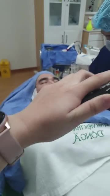 Quá trình điều trị sẹo lõm lần thứ 3 cho khách hàng