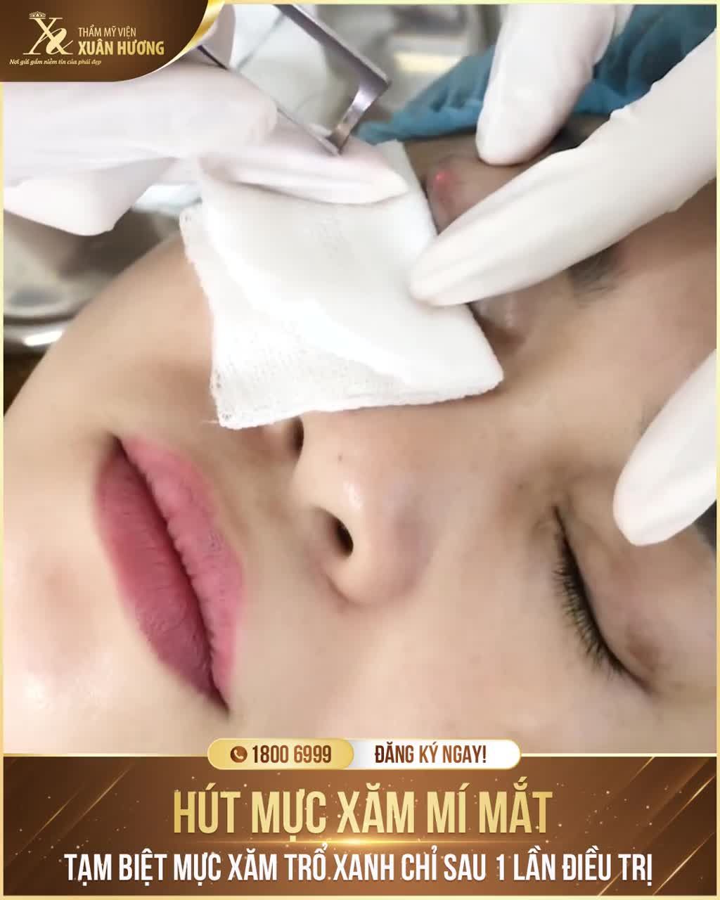 MỰC XĂM MÍ TO ĐẬM, ĐEN KÍN PHẦN MÍ KHIẾN ĐÔI MẮT "NẶNG TRĨU"