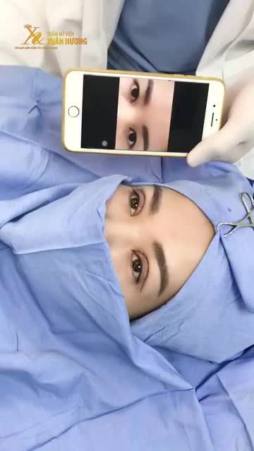 MẮT ĐẸP NGAY TRÊN BÀN TIỂU PHẪU CẮT MÍ MINIDEEP 6D TẠI TMV XUÂN HƯƠNG