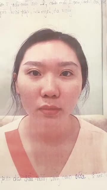 khách hàng sóng mũi thấp, đầu mũi to, mũi ngắn, da mỏng.