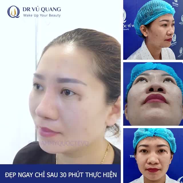 MŨI XẤU làm bạn kém may mắn. MŨI HẾCH làm bạn rơi hết tiền...