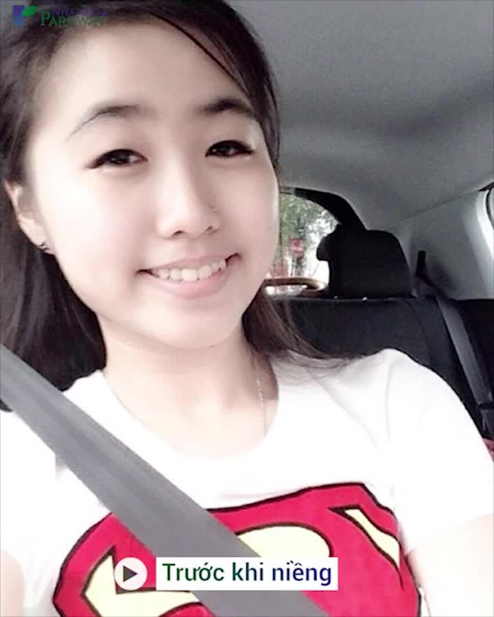 ĐIỀU GÌ KHIẾN INVISALIGN TRỞ THÀNH  KHAY NIỀNG TRONG SUỐT SỐ 1 THẾ GIỚI