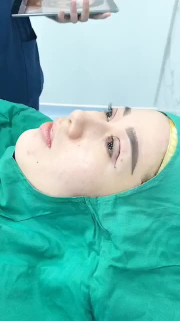 Mắt 4in1 CỰC ĐẸP ngay sau khi được làm