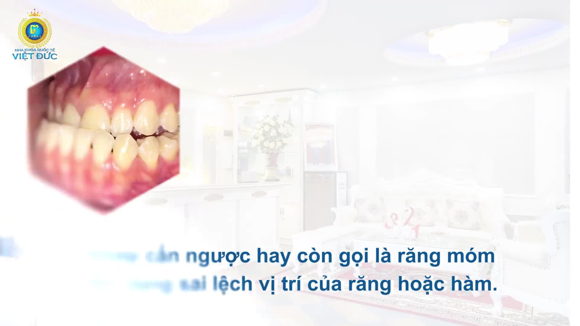 TỪ A-Z VỀ KHỚP CẮN NGƯỢC