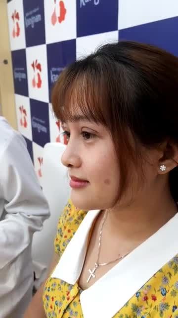 Combo mắt to tròn + mũi cao thanh tú với công nghệ cắt mí Plasma và Nâng mũi sline 4d tại Bệnh viện thẩm mỹ Kangnam