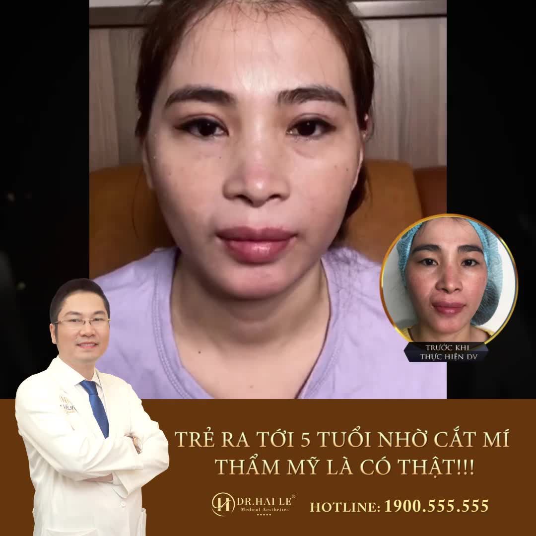 CHỈ CÒN 2 NGÀY CUỐI CÙNG, ƯU ĐÃI CỰC SỐC. NHANH TAY KẺO LỠ‼️