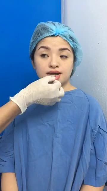 Chỉnh hàm móm  Có làm khó bác sĩ Đông Á?