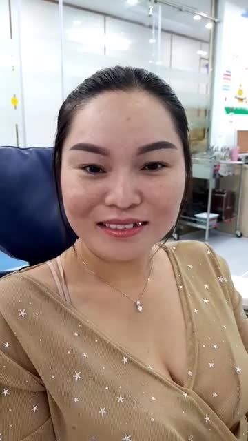 Tẩy trắng răng rapid white, "giải cứu" nụ cười!