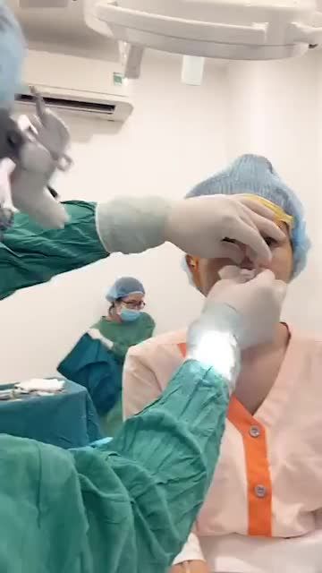 Livestream khách hàng sóng mũi thô và thấp, đầu mũi to, cánh mũi bè.