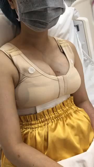 Hậu phẫu Treo ngực sa trễ ngày thứ 2- Tự tin diện đầm sexy khoe đường cong quyến rũ cùng Kangnam