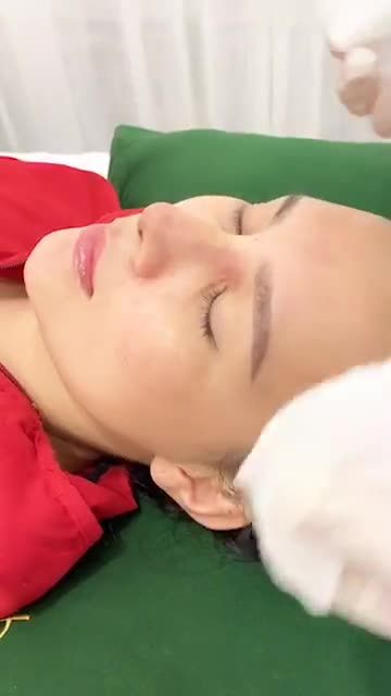 Cận cảnh quá trình tháo nẹp mũi tại Bác Sĩ Khải