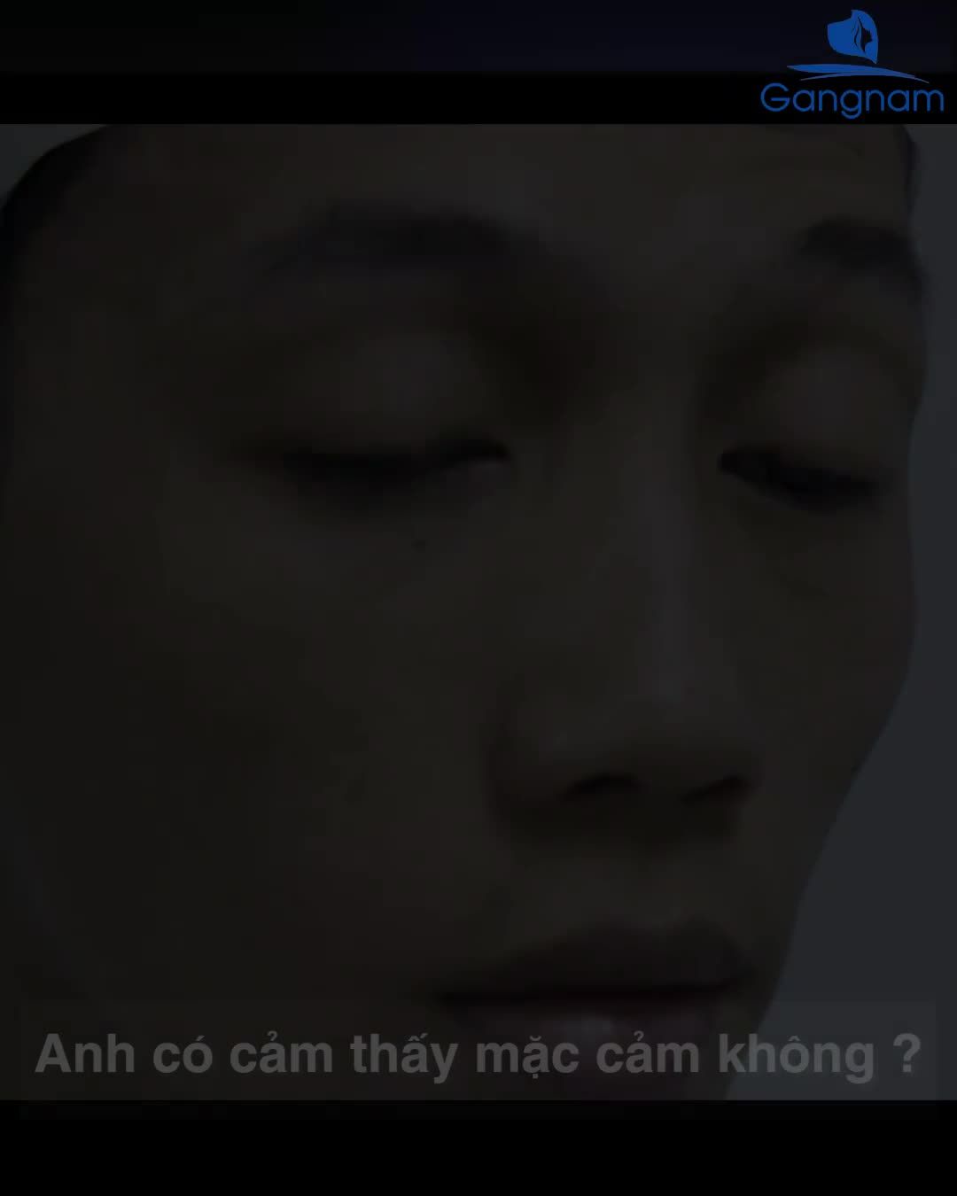 CHÀNG TRAI 20 NĂM VỚI ĐÔI MẮT SỤP CƠ - NAY ĐÃ KHÁC!