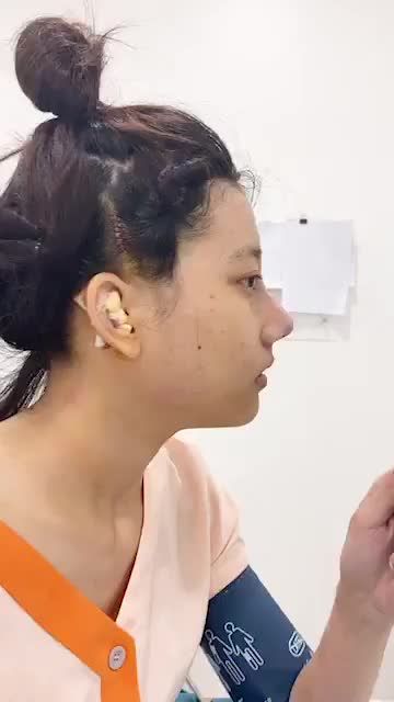 NÂNG MŨI CỰC KÌ NHẸ NHÀNG - KHÔNG ĐAU VÀ CỰC ĐẸP CHỈ SAU 90 PHÚT