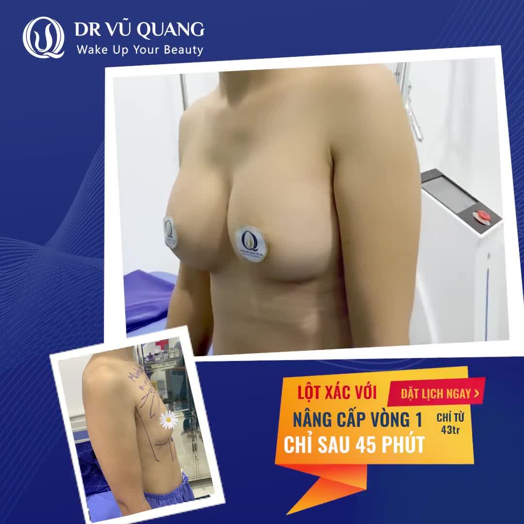 Cảm giác vòng 1 "sân bay" biến hình "núi đôi" sẽ như thế nào?