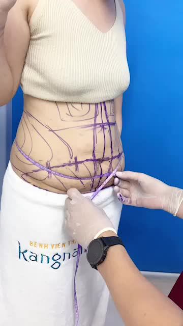 Thoát BỤNG MỠ đổi lại Eo Thon ngay hè này️ Tại sao không