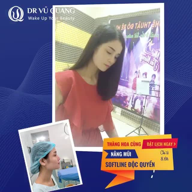 XAO XUYẾN với dáng MŨI SOFTLINE - ĐỘC QUYỀN TỪ DR VŨ QUANG.
