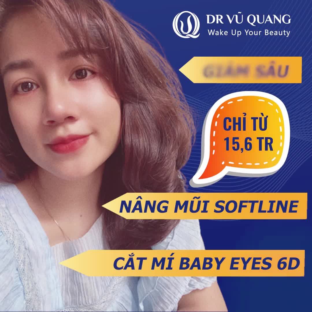 NÂNG MŨI SOFTLINE kết hợp CẮT MÍ BABY EYES 6D  Chỉ từ 15,6 TR
